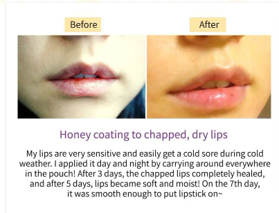 Hydrating Honey Lip Balm